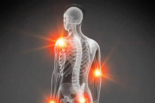 3d rendered medically accurate illustration of a mans painful joints